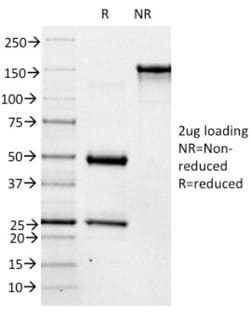 ABO, Blood Group A Antigen Antibody (3-3A), Novus Biologicals 0.2mg; Unlabeled:Antibodies,